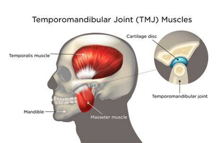 TMJD and Anxiety